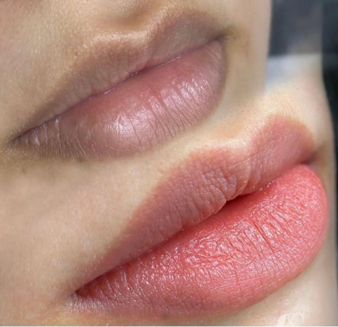 Melanin Rich Lips